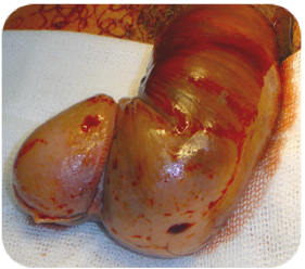 <span style="font-weight: bold;">FRACTURA DE PENE</span>